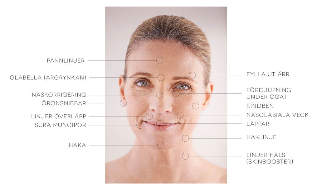 Rynkbehandlingmed restylane sk fillers